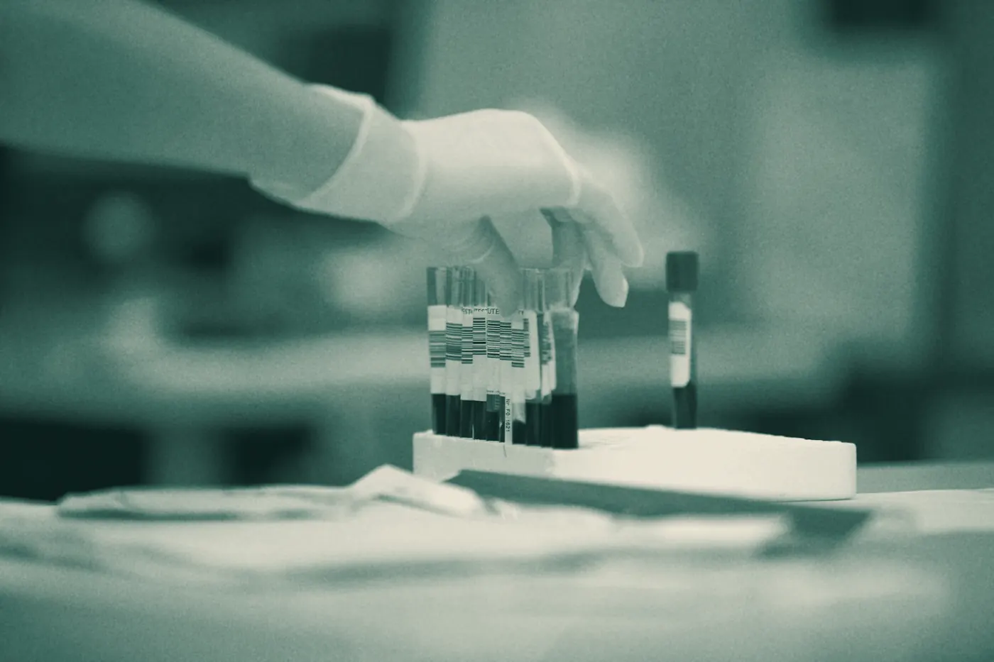 A gloved hand placing blood sample tubes in a rack for testing