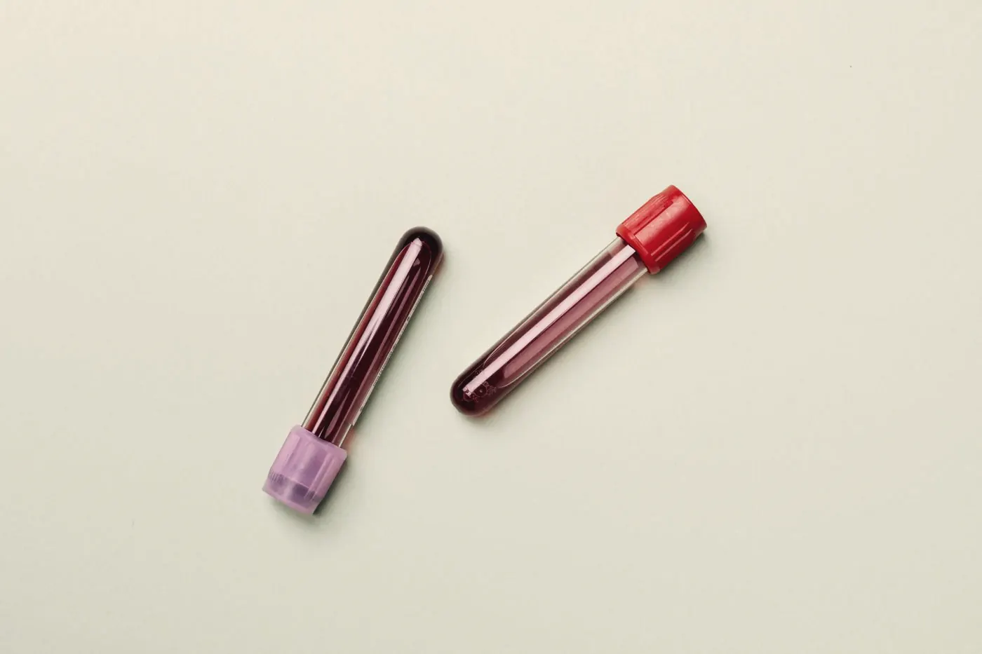 Blood sample tubes for the baseline HIV test included in a PEP package