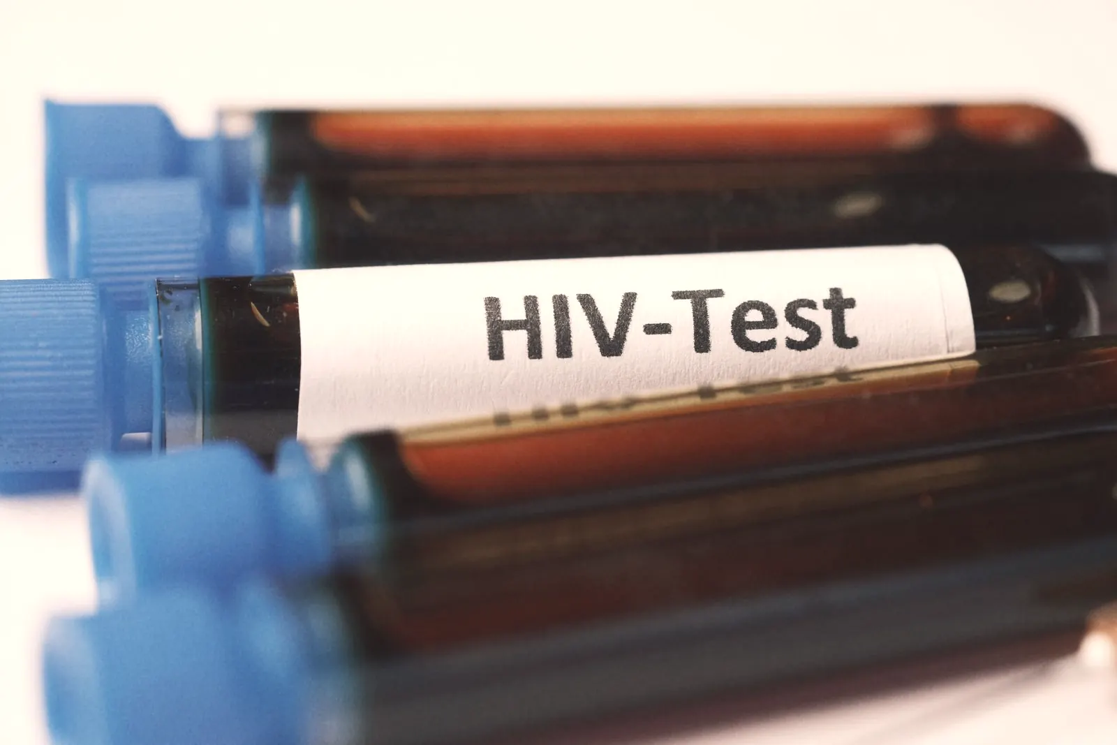 HIV Test in Pattaya: Types, Results & Prices