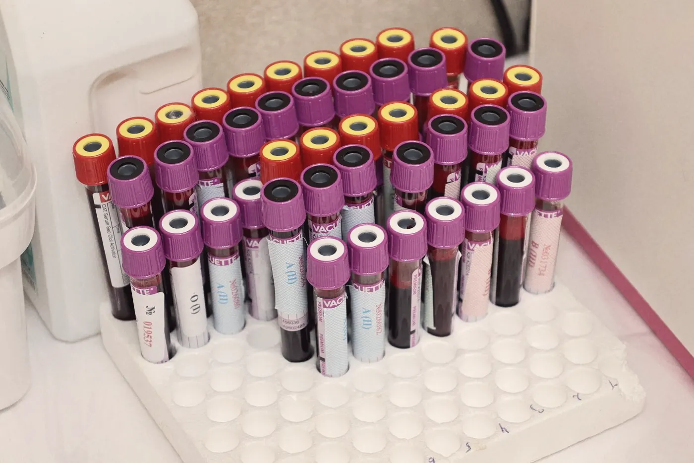 Rows of capped blood vials in a rack in a laboratory, waiting for analysis