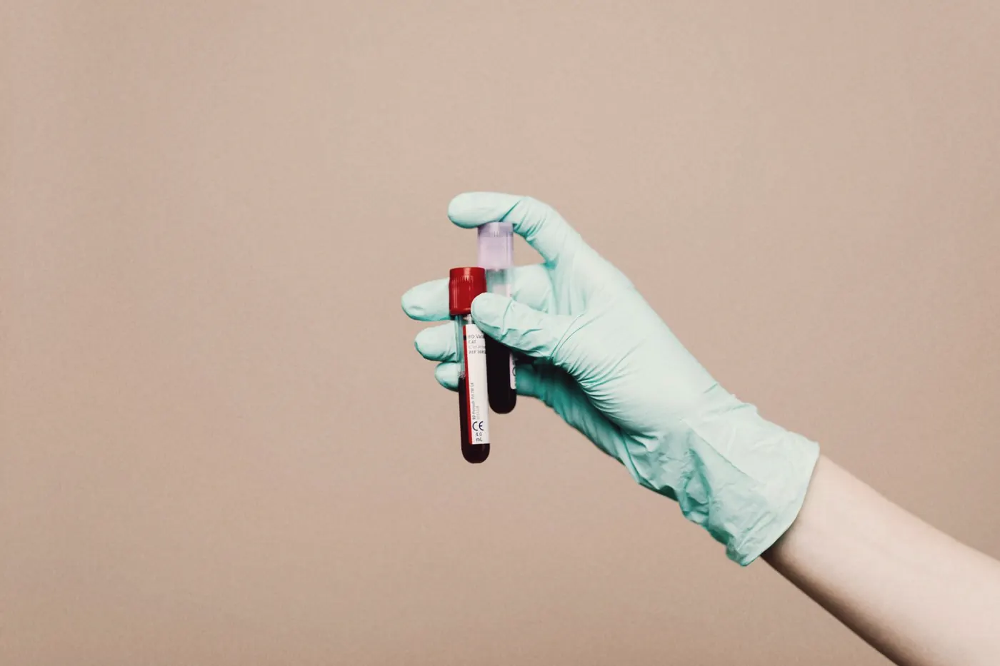A gloved hand holding blood sample tubes for tests before starting PrEP