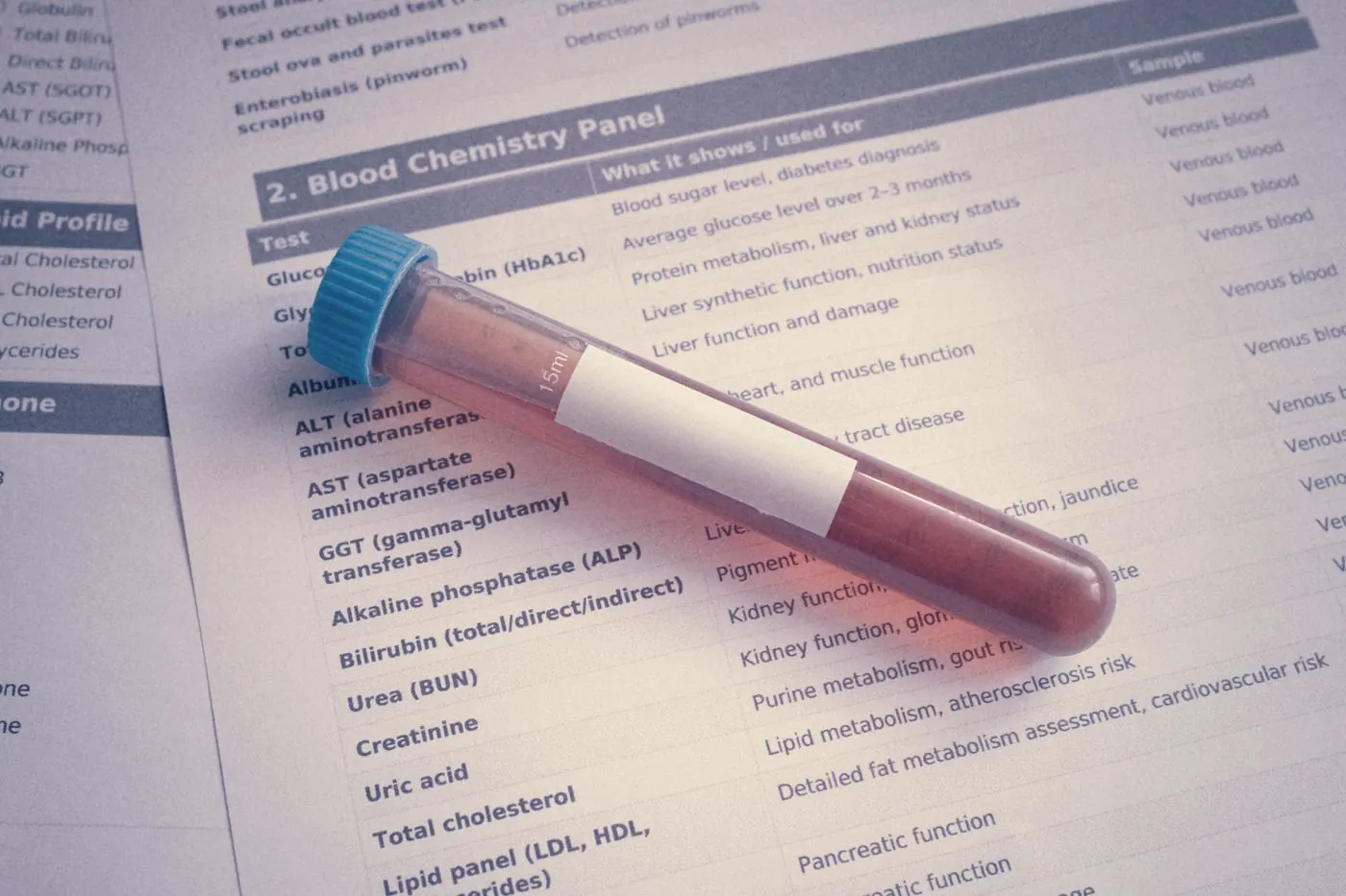 A blood sample tube resting on a blood chemistry panel that includes kidney tests