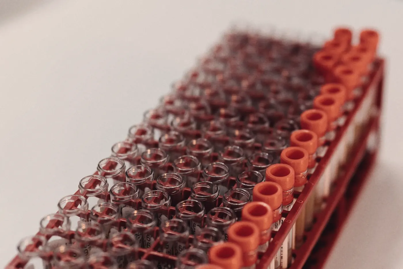 Laboratory sample tubes in a rack for STI and HIV testing